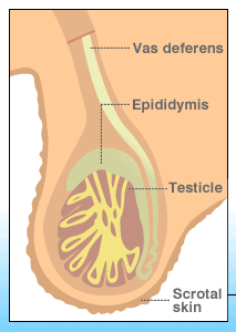 testicular_cancer