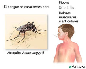 sintomas-dengue